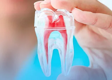 Endodontia: o que é e por que vale a pena se especializar?